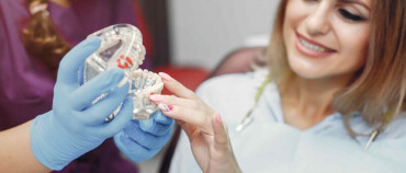 Crowns Vs. Veneers: Are the same dental procedures?