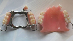 Metal Vs Acrylic Denture Melbourne