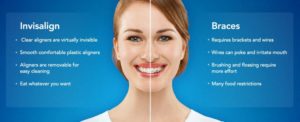invisalign dandenong