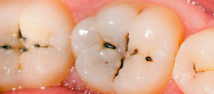 Dentist Endeavour Hills