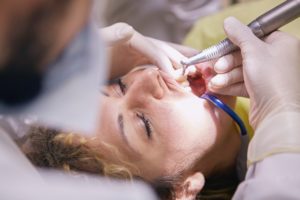 wisdom teeth removal melbourne
