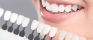 Porcelain Veneers Melbourne