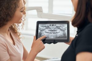 custom dental crowns in Endeavour Hills