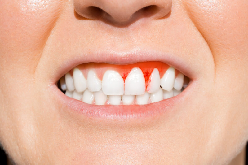 How Coffee, Wine & Energy Drinks Affect Your Teeth